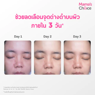 Mama's Choice เซรั่มบํารุงผิวหน้า สูตร Organic สำหรับผิวบอบบางแพ้ง่าย (30มล.) - Advanced Brightening Serum