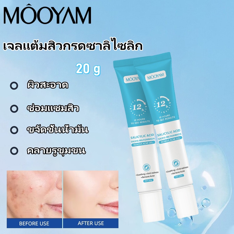MOOYAM Acne Gel เจลแต้มสิว เจลแต้มสิวกรดซาลิไซลิก มีคุณสมบัติต้านการอักเสบ สำหรับผิวบอบบางแพ้ง่าย20g