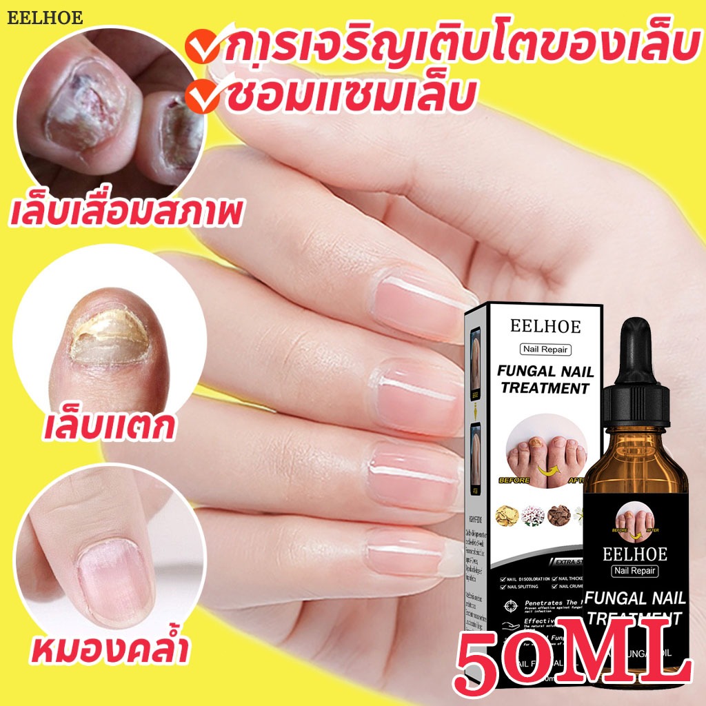 EELHOE 50ML เซรั่มบำรุงเล็บ น้ำยาบำรุงเล็บ บํารุงเล็บ ซ่อมแซมเล็บแตก เล็บเปราะ เล็บหนา Nail Care