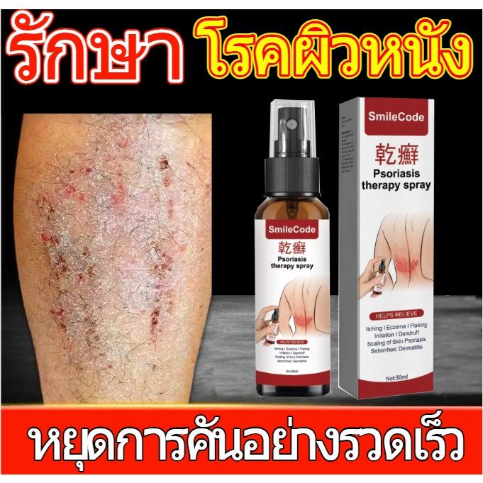 【COD】การกู้คืนอย่างรวดเร็ว สเปรย์บำรุงผิวร่างกาย spray