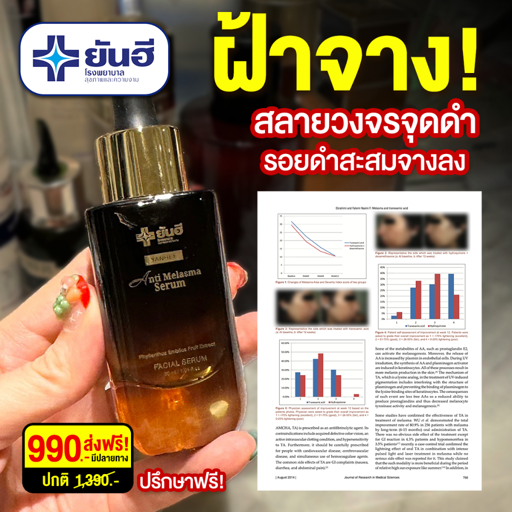 YANHEE ANTI MELASMA SERUM ยันฮี แอนตี้ เมลาสม่า รักษาฝ้า จุดด่างดำ รอยดำ ของแท้100% ส่งไว ถูกสุด — صورة 4