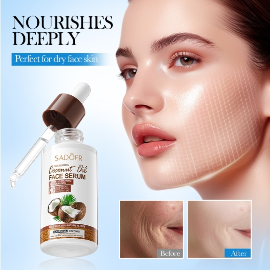SADOER Coconut Oil FACE SERUM เซรั่มมะพร้าว ชุ่มชื่น อ่อนโยน ฟื้นฟูผิว ทำให้ผิวบอบบาง ดูมีเสน่ห์ ขนา