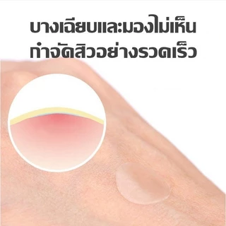 แผ่นแปะสิวรูปดาว แผ่นดูดสิว รูปดาวน่ารัก ขอบบาง กันน้ำ แต่งหน้าเนียน