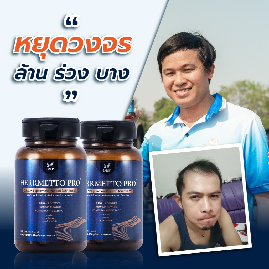 HERRMETTO Pro (เฮอร์เมตโต โปร) คอร์สดูแลเส้นผม แก้หัวล้าน บำรุงเส้นผม ให้หนาดกดำ ขนาด 60 แคปซูล