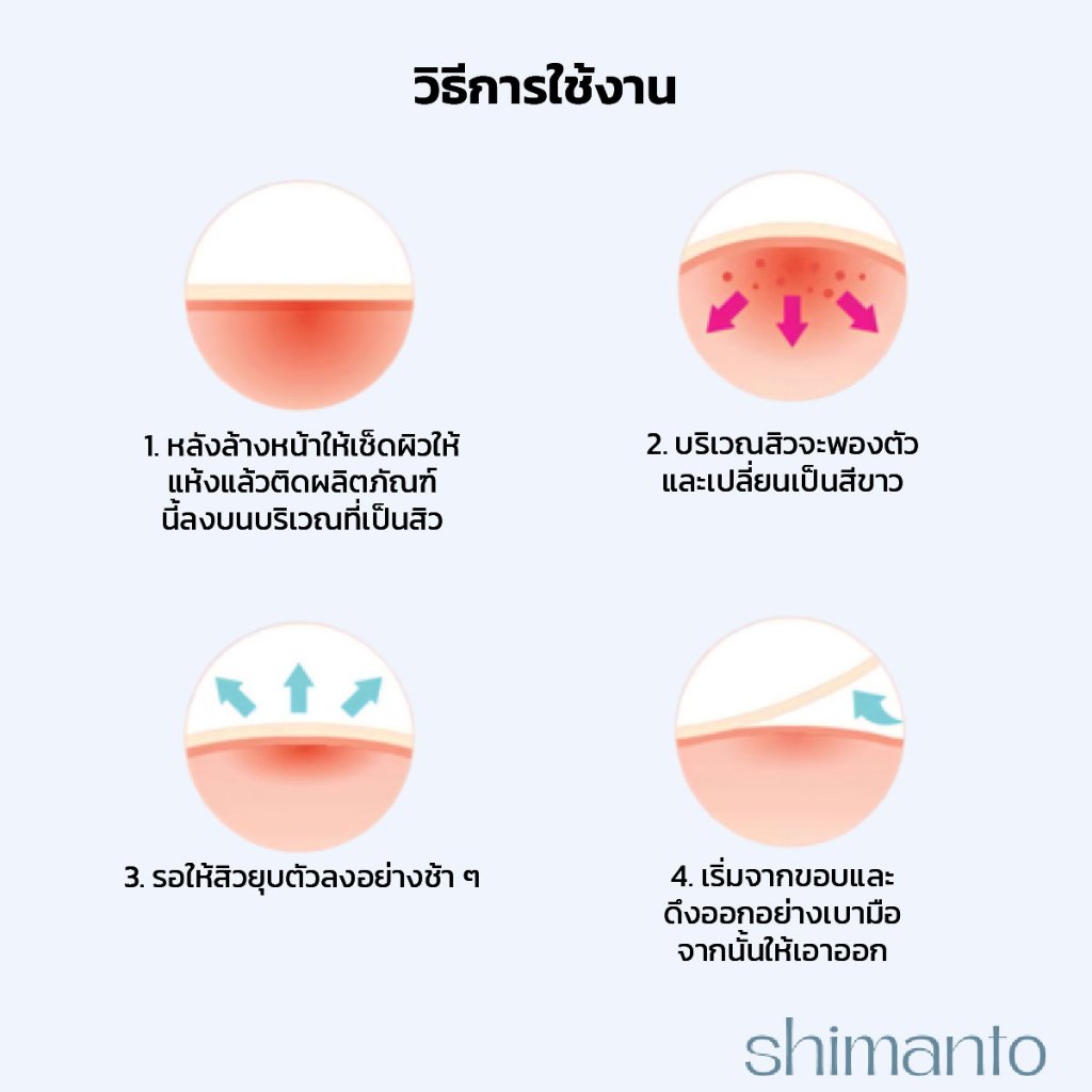 Shimanto แท้ แผ่นแปะสิว กันน้ำกันเหงื่อ ไม่มันเงา ผิวแพ้ง่ายใช้ได้ รักษาและปกปิดสิวอักเสบ - 1