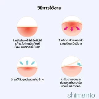 Shimanto แท้ แผ่นแปะสิว กันน้ำกันเหงื่อ ไม่มันเงา ผิวแพ้ง่ายใช้ได้ รักษาและปกปิดสิวอักเสบ