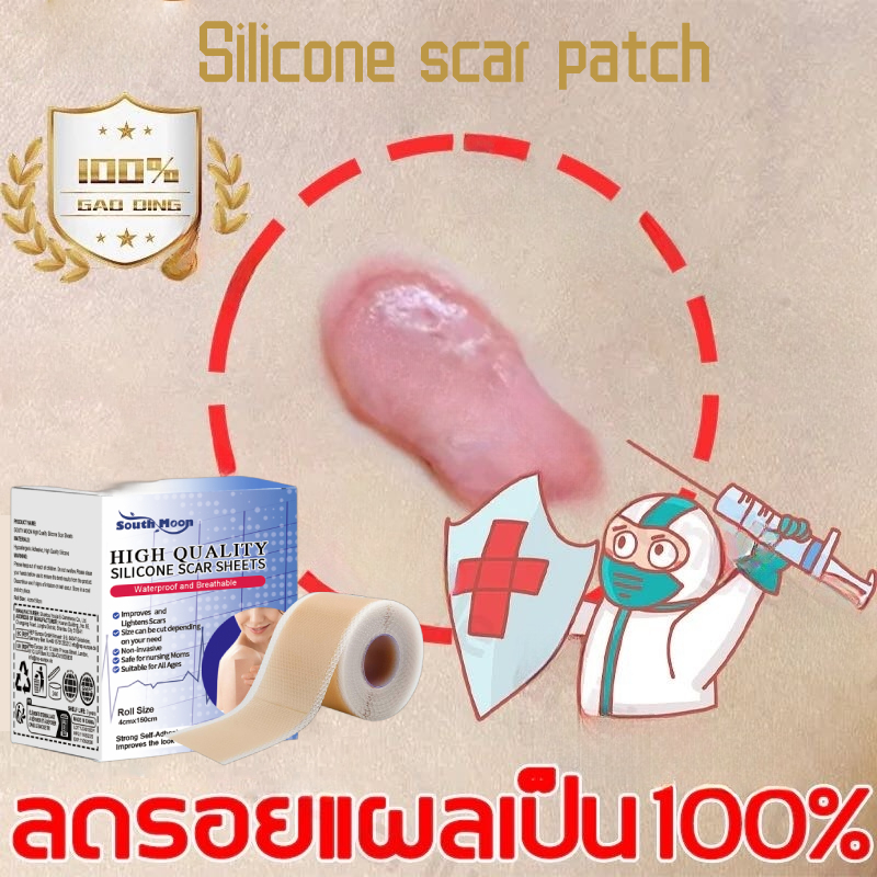 【 จัดส่งจากกรุงเทพฯ】south moon แผ่นแปะแผล silicone scar sheet แผ่นแปะแผลเป็น 4cm*150cmํ ปิดแผลเป็น