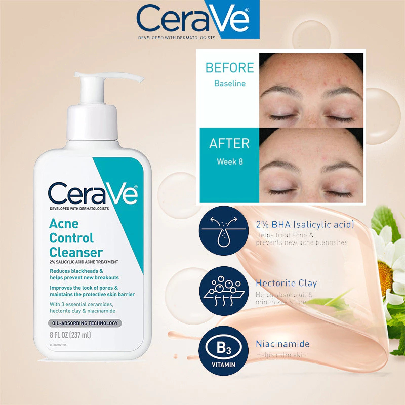 Cerave acne control cleanser คลีนเซอร์ทำความสะอาดผิว สดการเกิดสิว สำหรับผิวเป็นสิว 236ml