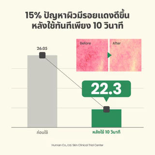 AXIS-Y |Dark Spot Correcting Glow Toner 125 ml.|ดาร์ก สปอต คอร์เรคติ้ง โกลว์ โทนเนอร์