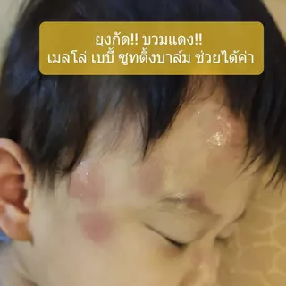 เมลโล่ เบบี้ ซูทติ้งบาล์ม บาล์มทาหลังยุงกัด ลดรอยดำ ลดบวมฟกช้ำ หัวโน ลดรอยยุงกัด ขาลาย Mellow Baby Soothing Balm