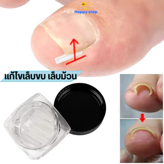 ็Happy step อุปกรณ์แก้ไขเล็บขบ 10 ชิ้น/ขวด เล็บคุด แก้ไขเล็บม้วน เล็บงุ้มแทงเนื้อ รูปตัว C ร้านไทย