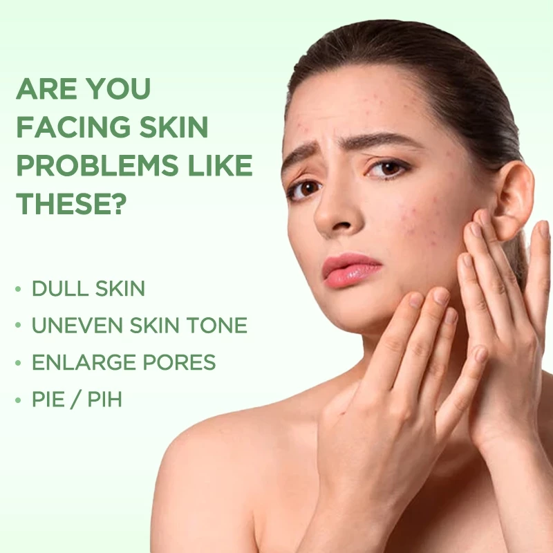 PAZIUM มาร์คหน้า มาส์กโคลน Cleansing Mask ทำความสะอาดลึก ดูดซับความมัน ไม่แห้งผิวลดสิวหัวดำ ความมัน 42G thumbnail 3