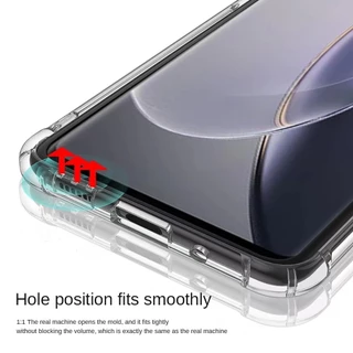 เคสใสแข็ง คิงคอง สำหรับ Vivo Y02 Y02A Y02T Y02S Y16 Y15S Y01 Y01A Y19 Y31 Y51 Y30 Y50 Y72 Y76 Y91C Y1S V27 Pro V23 V23E