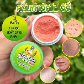 ครีมไฝจีจี้ ขี้แมลงวัน ติ่งเนื้อ หูด ตาปลา แก้ปัญหา กระ สิวหิน ครีมแต้มไฝจีจี้ไฝ หูด จี้ไฝ แต้มไฝ