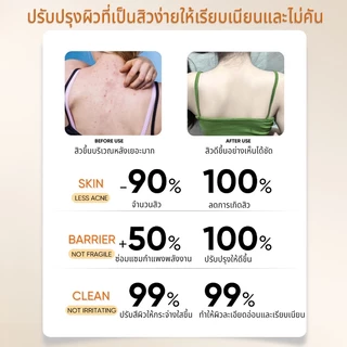 LYDIMOON เจลอาบน้ำแอนตี้แบคทีเรีย สบู่อาบน้ํา เจลอาบน้ำแก้คัน 500ml กำมะถันครีมอาบน้ำ ลดรอยดำ ผดผื่น สิวหลัง หน้าอก หลัง