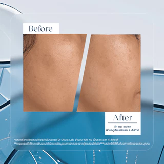 Dr.Olivia Rebalancing Cream 30 ml. (มอยซ์เจอร์ไรเซอร์ตอบโจทย์ทุกผิวที่ผิวสุขภาพดีต้องการ มี Ectoin สูงถึง 7%)