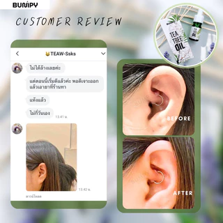 Tea Tree Oil ทีทรีออยล์ทาแผลหลังเจาะ แผลบั๊มพ์ (มี อย.) ทาสะดือ คิ้ว จมูก หู ปากภายนอก ลดอักเสบ ระบม แดง ปวดหลังเจาะ