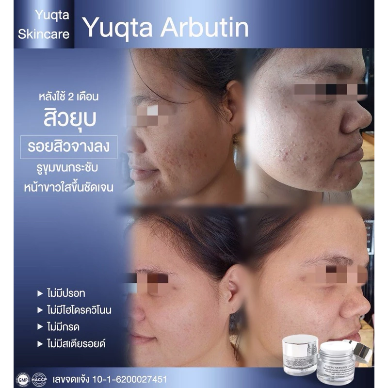 Alpha Abutin Cream__30g (ยุกตา สกินแคร์) thumbnail 9