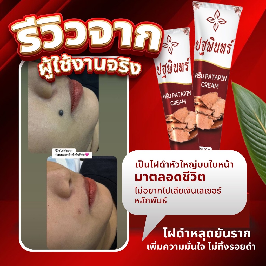 รูปภาพ 5