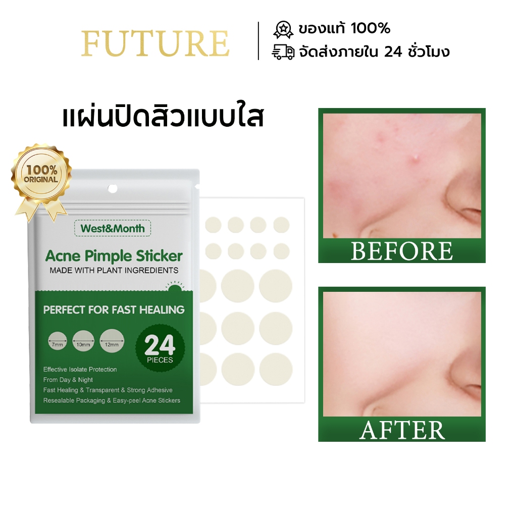 WestMonth แผ่นแปะสิว แผ่นดูดสิว แผ่นปิดสิวแบบใส แผ่นปิดสิวอักเสบ แผ่นปิดสิวเสี้ยน Acne Pimple Patch