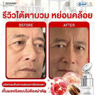 อายเซรั่ม ลดริ้วรอย ตีนกา Yanhee Cryo-Recovery Eye Serum [ของแท้ 100%] ยันฮี ลดรอยใต้ตา