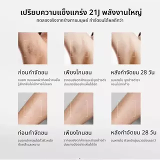【รับประกัน2ปี】SiIk'n IPL เครื่องกำจัดขนด้วยเลเซอร์ 21J (ไม่จำกัดช็อต）สูตรเย็น เครื่องกำจัดขนถาวร Multi Function