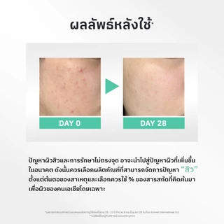 NU FORMULA Acne Solution Ampoule Serum 30ml เซรั่มดูแลปัญหาสิว BHA 2% ลดรอยแดง รอยสิว รอยดำจากสิว