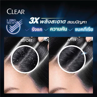 [ แพ็คคู่แชมพู ]🧊CLEAR ❄️เคลียร์ แชมพูขจัดรังแค 370 มล. แชมพู+แชมพู แชมพูเคลียร์ แชมพูขจัดรังแค บำรุงหนังศีรษะ ขวดปั๊ม