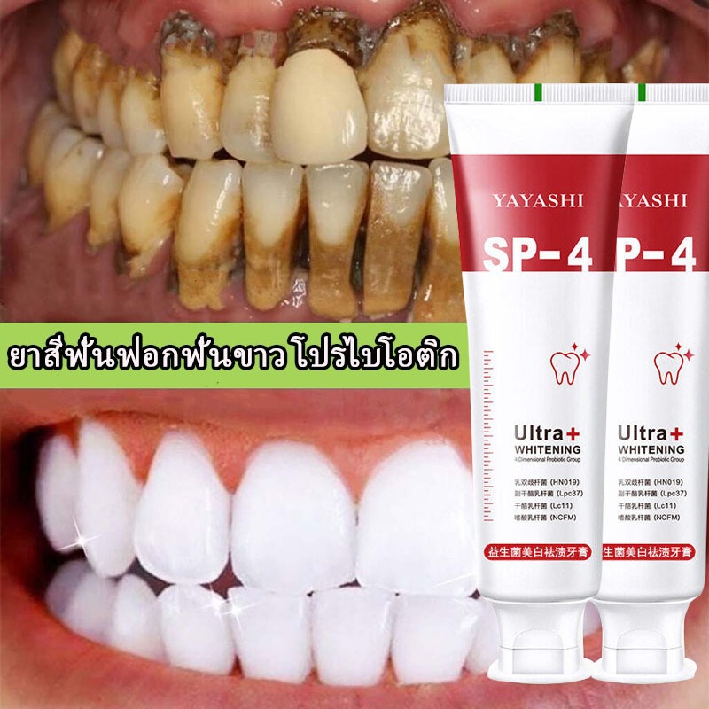 SP-4 น้ำยาฟอกสีฟันขาว ยาสีฟันไวท์เทนนิ่ง ขจัดคราบหินปูนสีเหลือง ขจัดคราบจุลินทรีย์ เพิ่มความแข็งแรงฟัน ซ่อมแซมฟัน