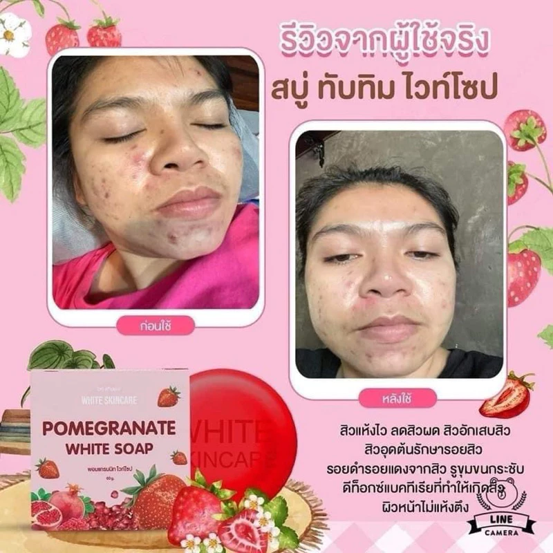 สบู่ทับทิม หมู่ไวท์ ลดสิว ผิวหมองคล้ำ thumbnail 9