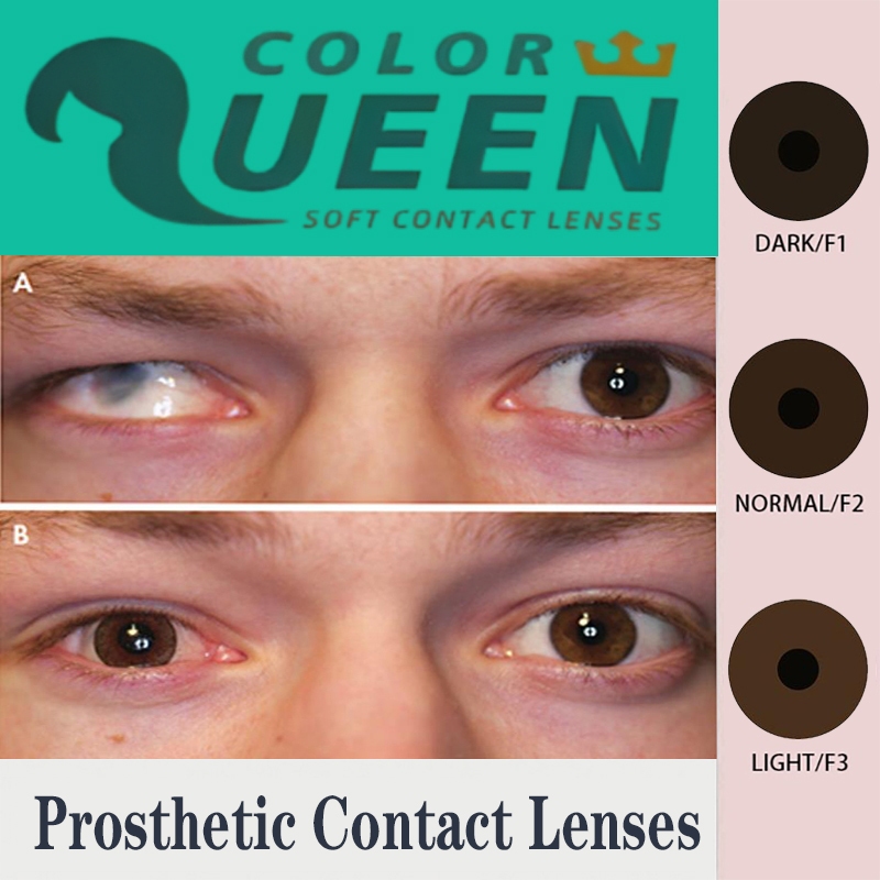 Prosthetic Contact Lens Eye Defects Iris Lenses aesthetic lenses คอนแทคเลนส์เทียม (2pcs)