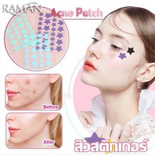 แผ่นแปะสิวรูปดาว แผ่นดูดสิว รูปดาวน่ารัก ขอบบาง กันน้ำ แต่งห…