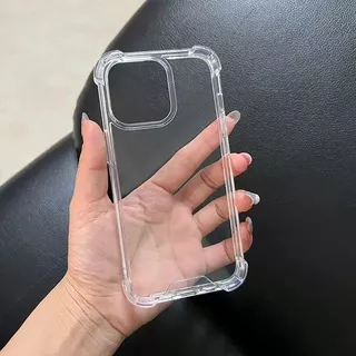 เคสใส คิงคอง สำหรับ Vivo Y05 Y31D V60 lite Y39 Y04 V50 lite X200 Pro Y300 Y19S Y200 V60lite กันกระแทก For วีโว่ X200Pro