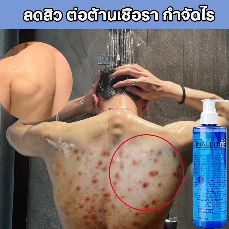 เจลอาบน้ํา ครีมอาบน้ำลดสิว เจลอาบน้ำไวท์เทนนิ่งผิว 300ml อ่อนโยนไม่ระคายเคือง กำจัดไร ล้างให้มีผิวสวยใสไร้สิวออ