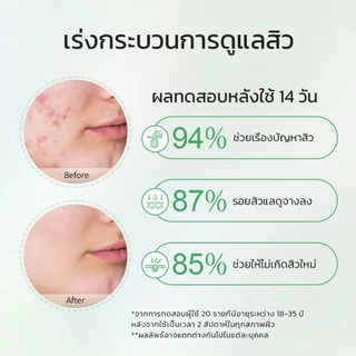 【Proxie's Pick】Glad2Glow Centella Salicylic Acid Acne Serum เซรั่ม เซรั่มบำรุงผิวหน้า เซรั่มลดรอยสิว เซรั่มหน้าใส