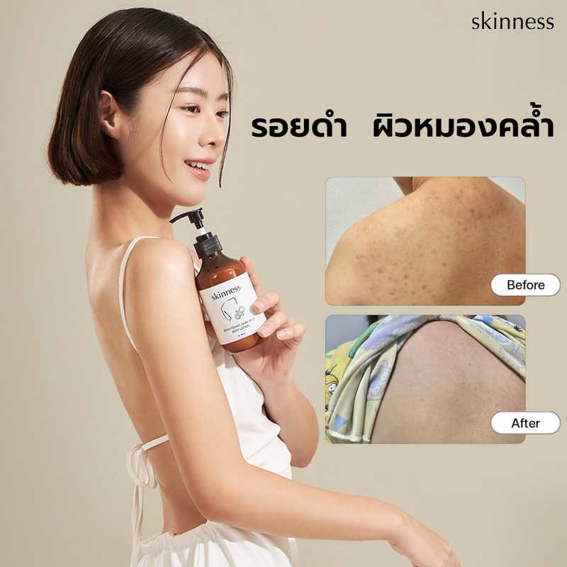 พร้อมส่ง❗️𝗦𝗞𝗜𝗡𝗡𝗘𝗦𝗦 🤍skinness brightening dark spot body lotion โลชั่นบำรุงผิว เพื่อผิวขาวกระจ่างใส ล