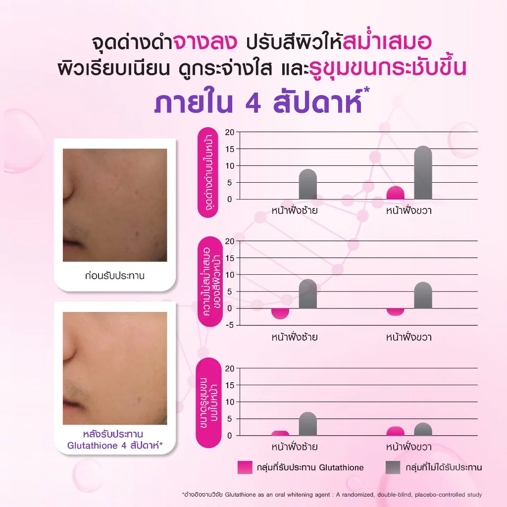 [สูตรผิวออร่า] Bomi R-Gluta X 30 Tablets โบมิ อาร์-กลูต้า เอ็กซ์ วิตามินผิวเข้มข้น แลดูผิวขาวสว่างใส ดุจเปิดไฟให้ผิว thumbnail 6