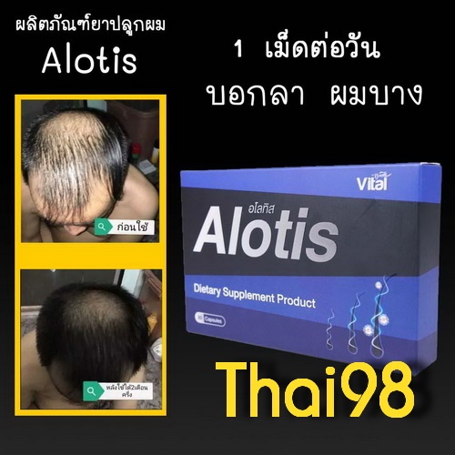 ยาปลูกผม อโลทิส Alotis 2กล่อง ของแท้ 100% มี อย.ทุกกล่อง ราคาโรงงาน แถมเซรั่ม 10มล. 2ขวด