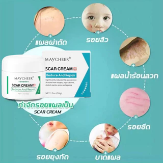 【มีสินค้าพร้อมจัดส่ง】ALIVER 50ml ครีมลดรอยแผลเป็น แผลเป็น ลดเลือนแผลผ่าตัดการคลอด แผลผ่าตัด แผลเป็นใหม่และแผลเป็นเก่า