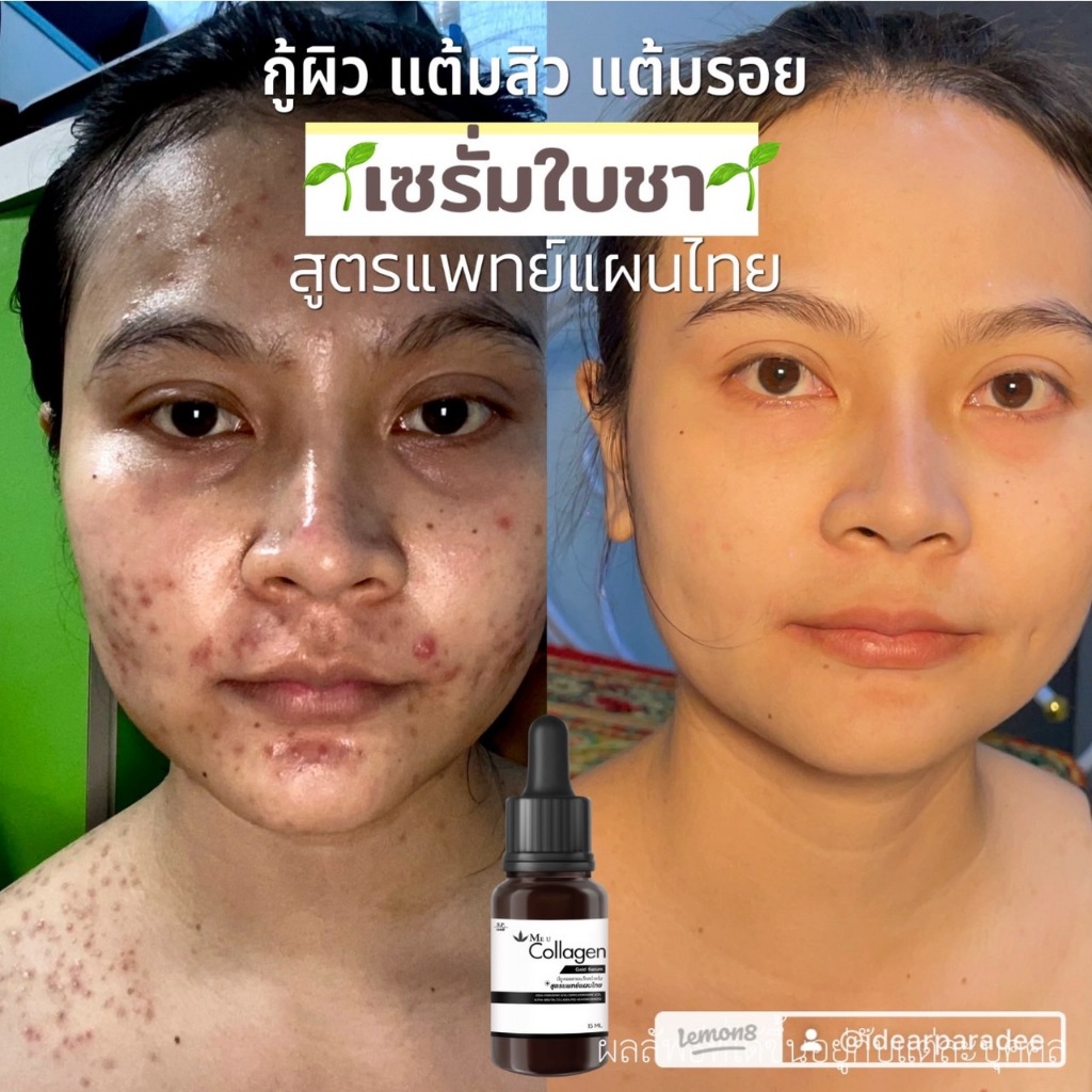 เซรั่มใบชา สูตรแพทย์แผนไทย Collagen Gold Serum