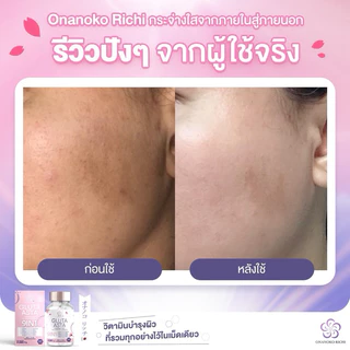 onanokorichi โปรเคลียร์สต็อค หมดอายุ ตค 69