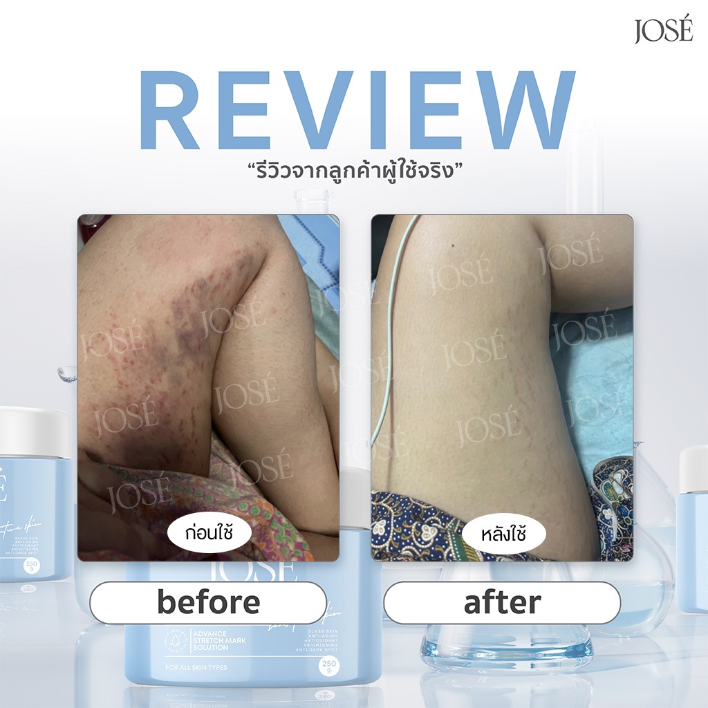 [ในไลฟ์สดส่วนลด 50%] JOSE White Plus Body Cream ครีมโจเซ่ ไวท์พลัส บำรุงผิวกาย ขนาด 250 กรัม (แพ็กเกจใหม่) รูปที่ 5