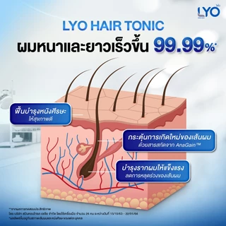 [ มินิเซ็ต ] LYO ไลโอ หนุ่มกรรชัย | Hair tonic โทนิค ปลูกผม Shampoo แชมพู ยาสระผม ลดผมร่วง e-tax