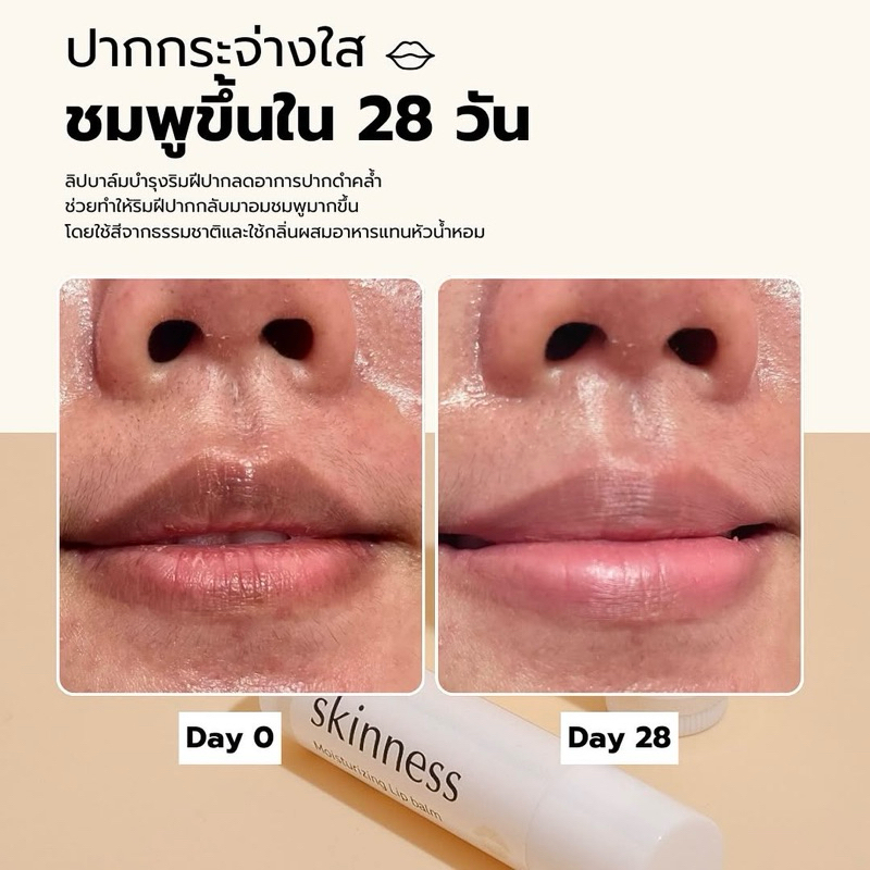 (พร้อมส่ง)𝗦𝗞𝗜𝗡𝗡𝗘𝗦𝗦 🤍 skinness moisturizing lip balm👄