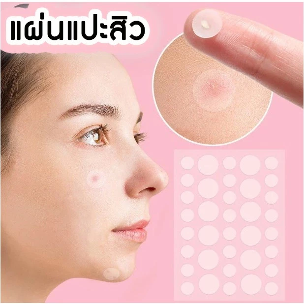 แผ่นแปะสิว ช่วยลดอาการอักเสบให้สิวยุบไว ช่วยดูดสิว รักษาสิว ขอบบาง กันน้ำรักษาสิว ลดการอุดตัน 36 ชิ้น พร้อมส่งด่วนจากไทย