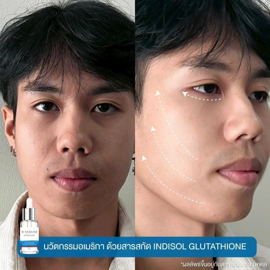โปร 4ขวดแถม1 B Serum Skincare บีเซรั่มสกิลแคร์ หน้าตรึงสกินแคร์ เซรั่มบำรุงผิว thumbnail 6