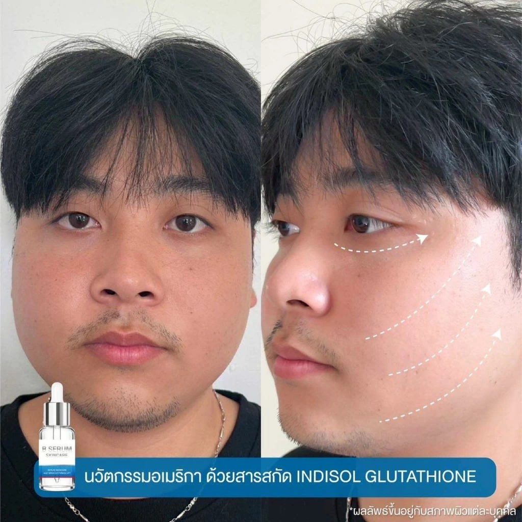 โปร 4ขวดแถม1 B Serum Skincare บีเซรั่มสกิลแคร์ หน้าตรึงสกินแคร์ เซรั่มบำรุงผิว thumbnail 7