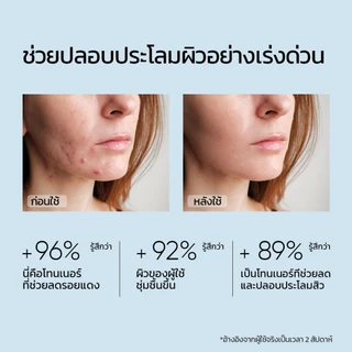 SKINTIFIC 5X CERAMIDE SOOTHING TONER 80ml 5X เซราไมด์ น้ําตบ โทนเนอร์ ปลอบประโลมผิวที่บอบบาง ให้ความชุ่มชื้นแก่ผิว