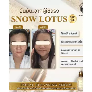 📍เซ็ทหน้าเด็ก เซรั่มล้างหน้า + ครีมทาหน้า มาดามหลุยส์ บัวหิมะทองคำ 24 K Snow Lotus