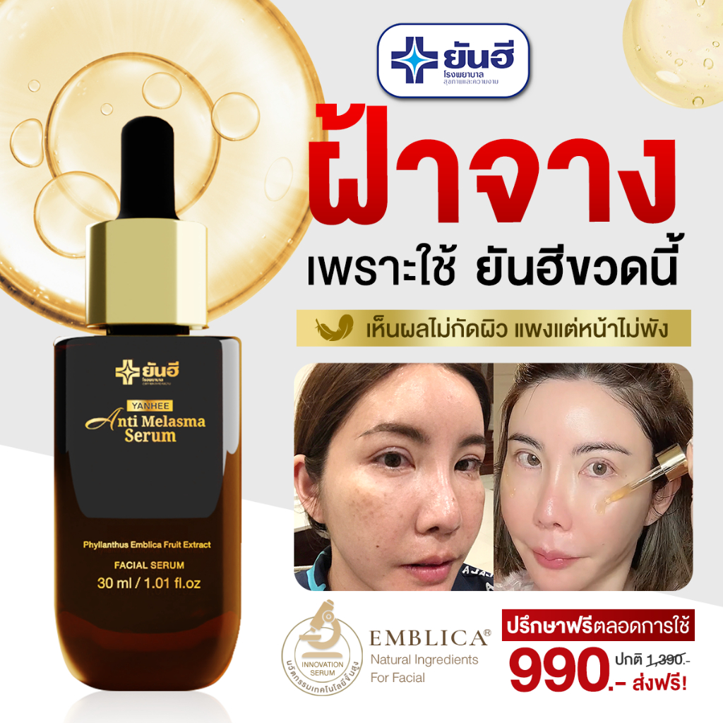 YANHEE ANTI MELASMA + RED Serum ส่งไว ถูกสุด ยันฮีเซรั่ม แอนตี้ เมลาสม่าเซรั่มรักษาฝ้าจุดด่างดำ - รูปที่ 4
